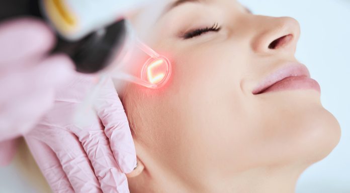 laser treatments